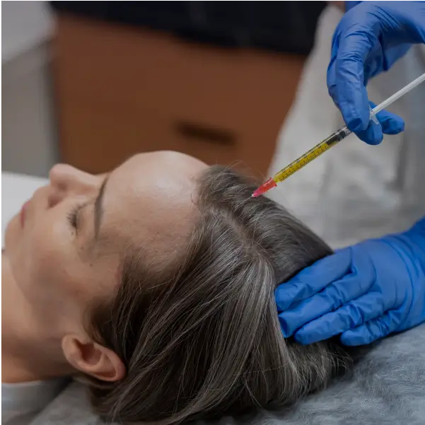 Terapia Capilar - 6 meses